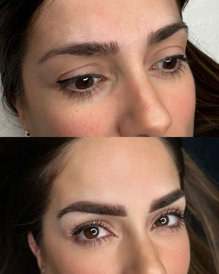 Antes y después de micropigmentación de cejas